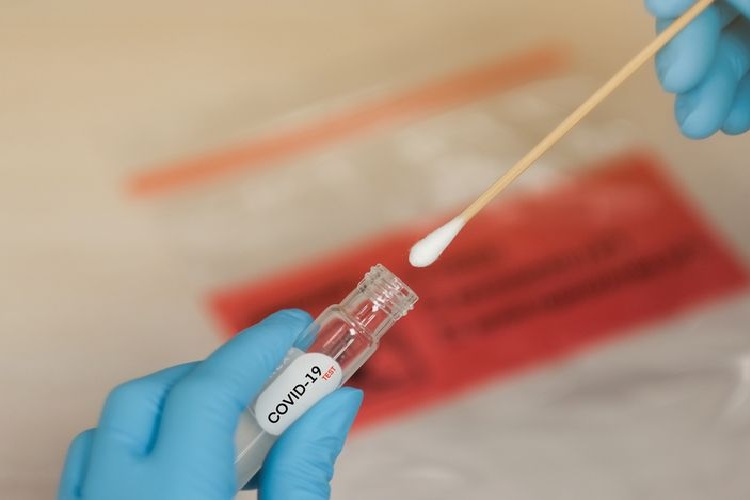 MENGAPA HASIL SWAB PCR UNTUK COVID-19 BERBEDA? - Jurusan Farmasi Fakultas MIPA UII