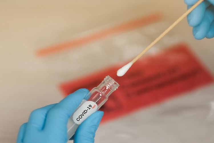 Jenis swab test covid 19